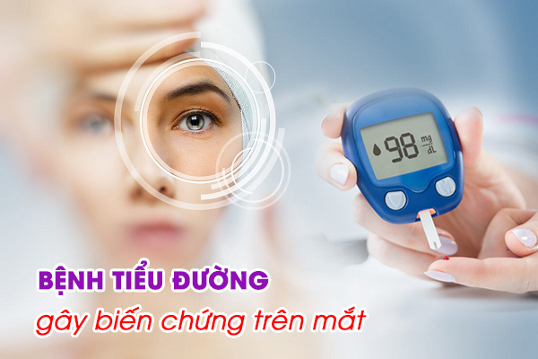 Vì sao bệnh tiểu đường gây biến chứng trên mắt?