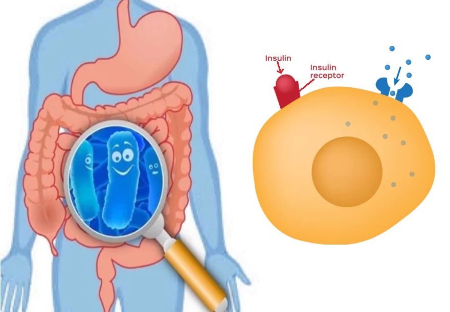 Bổ sung lợi khuẩn giúp cải thiện tình trạng kháng insulin
