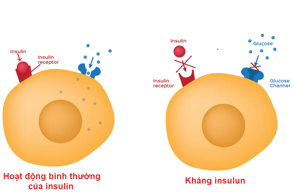 Hiện tượng kháng insulin ở tế bào