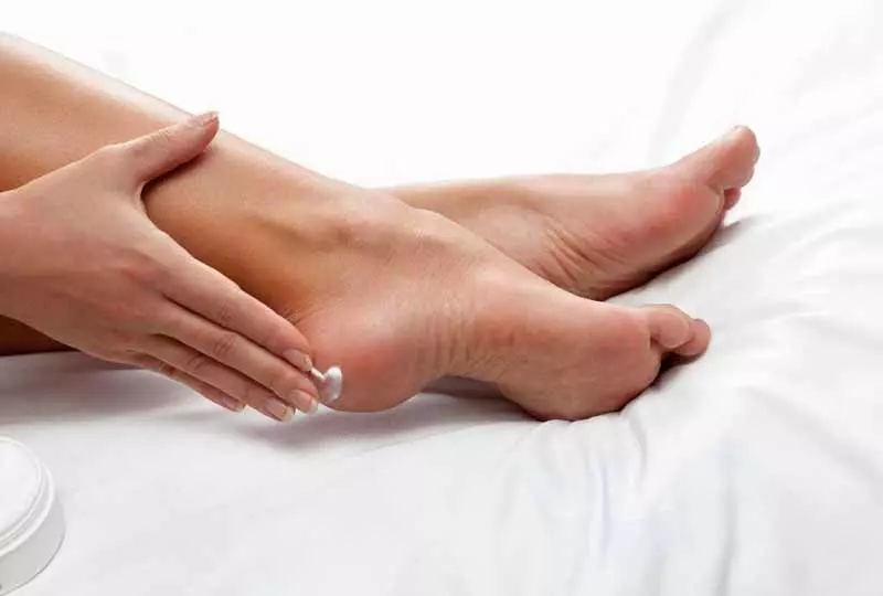 Bạn nên bôi kem dưỡng ẩm chân hàng ngày để tránh nứt nẻ