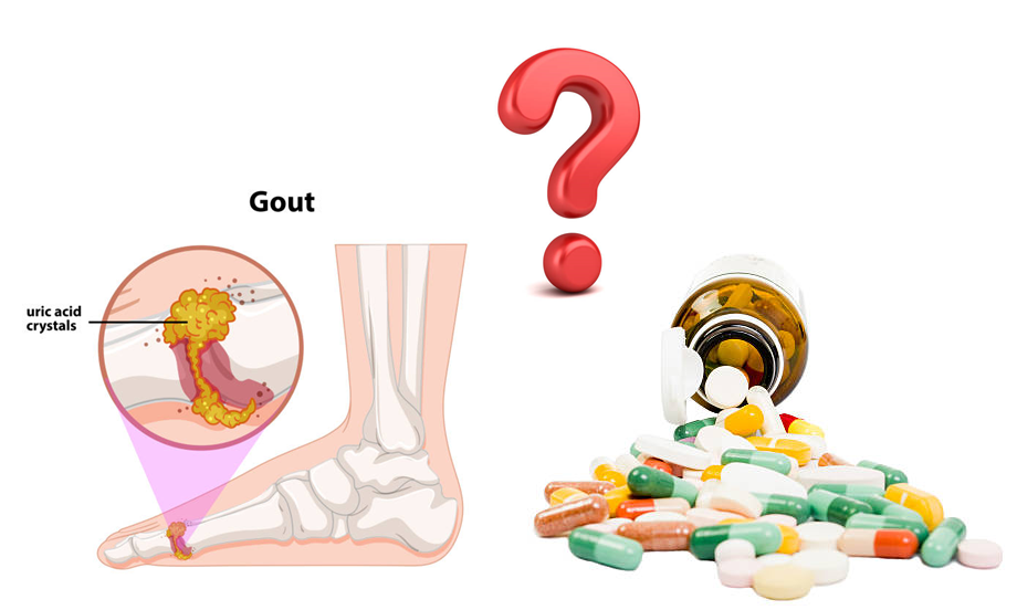 Bệnh gút uống thuốc gì? Hướng đi tối ưu nhất dành cho người bệnh!