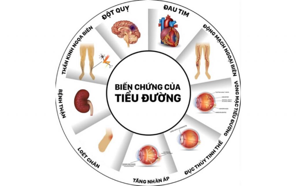 bien-chung-tieu-duong-giai-doan-lam-sang