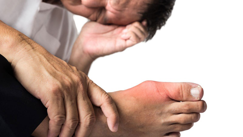 Người bị bệnh gút có uống thuốc dưỡng khớp được không?